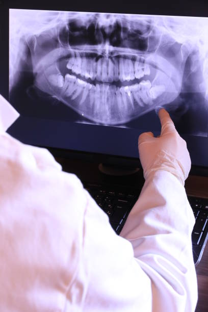 Best Emergency Root Canal Treatment in Oak Bluffs, MA
