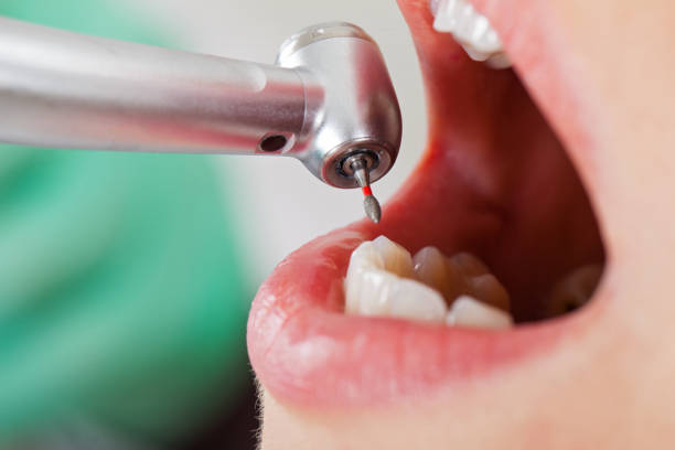 Best Same-Day Emergency Dental Services in Oak Bluffs, MA